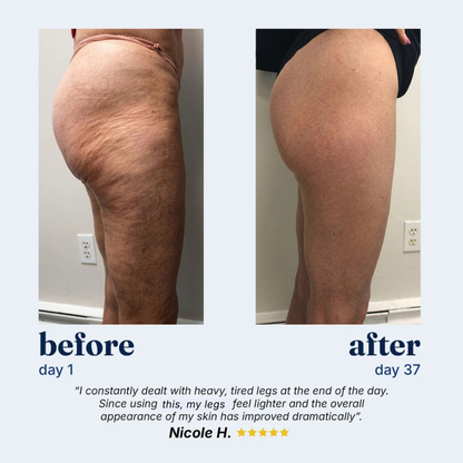 Body Sculpting & Cellulite Massager