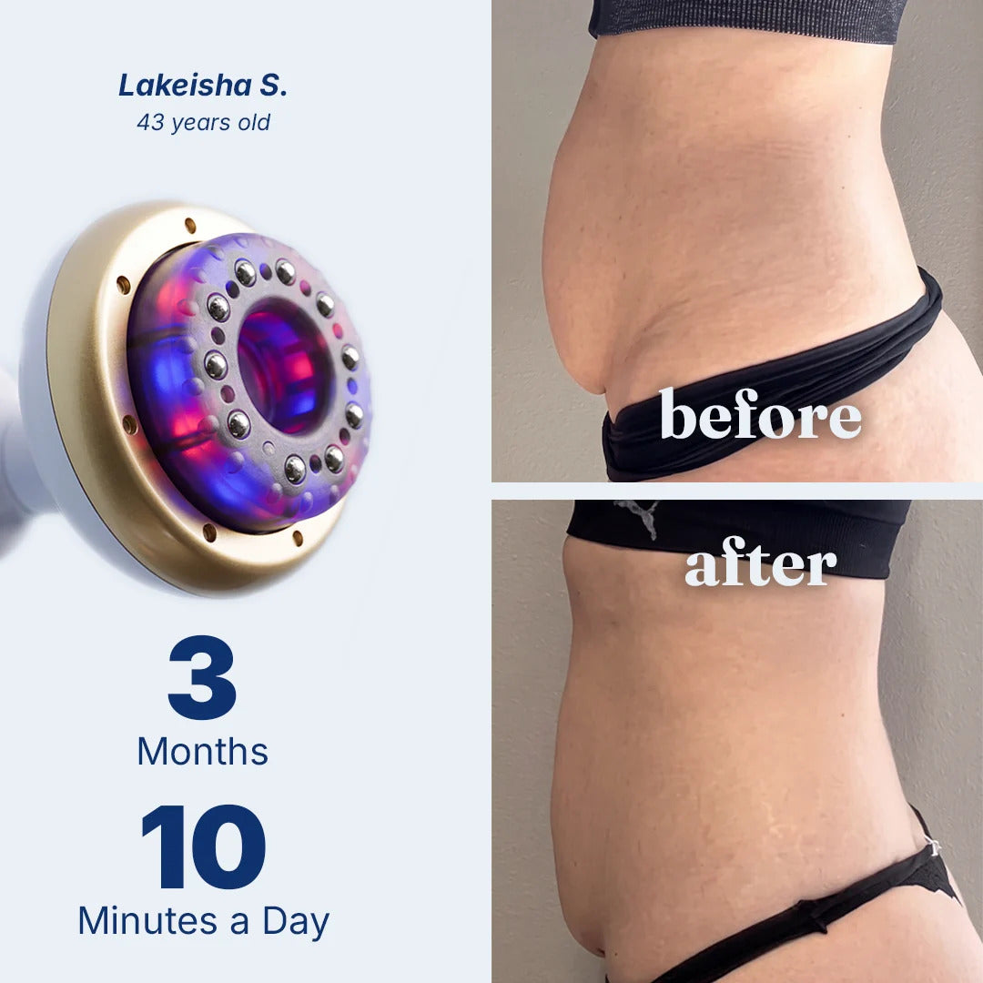 Body Sculpting & Cellulite Massager